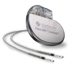 Pacemaker Photo